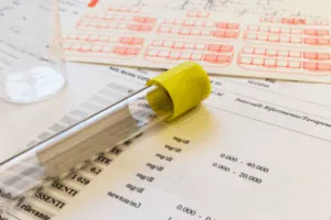 Provetta per analisi su modulo di laboratorio
