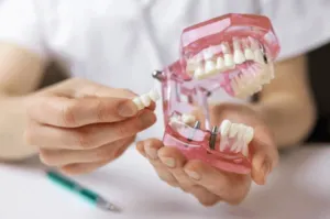 impianto dentale garanzia